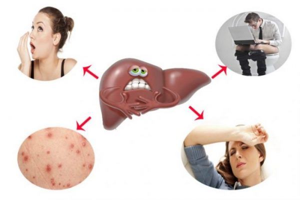 giải độc gan giải độc gan